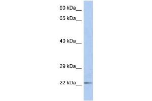 DUT antibody used at 1 ug/ml to detect target protein. (Deoxyuridine Triphosphatase (DUT) (N-Term) Antikörper)