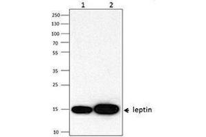 Western Blotting (WB) image for anti-Leptin (LEP) antibody (ABIN2665227) (Leptin Antikörper)