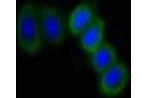 Immunofluorescent analysis of HepG2 cells using ABIN7169807 at dilution of 1:100 and Alexa Fluor 488-congugated AffiniPure Goat Anti-Rabbit IgG(H+L) (SLITRK6 Antikörper  (AA 621-821))