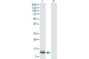 Western Blot analysis of CARD17 expression in transfected 293T cell line by CARD17 monoclonal antibody (M01A), clone 1G6.