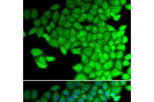 Immunofluorescence analysis of HeLa cells using MYL2 Polyclonal Antibody (MYL2 Antikörper)