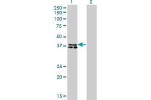 Western Blot analysis of B4GALT4 expression in transfected 293T cell line by B4GALT4 monoclonal antibody (M01), clone 5E2. (B4GALT4 Antikörper  (AA 35-134))
