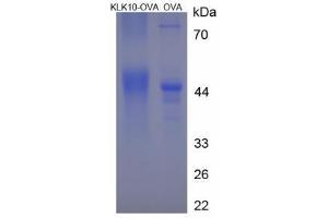 Image no. 2 for Kallikrein 10 (KLK10) (AA 225-240) peptide (Ovalbumin) (ABIN5666256)