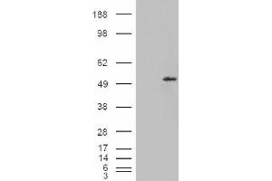 Image no. 2 for anti-STEAP Family Member 4 (STEAP4) (C-Term) antibody (ABIN375107) (STEAP4 Antikörper  (C-Term))