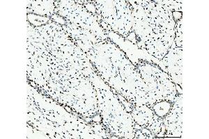 IHC analysis of MCM6 using anti-MCM6 antibody (ABIN7600037). (MCM6 Antikörper  (AA 14-821))