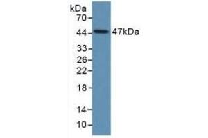 Detection of Recombinant PAI1, Human using Monoclonal Antibody to Plasminogen Activator Inhibitor 1 (PAI1) (PAI1 Antikörper)