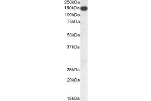 Western Blotting (WB) image for anti-Thrombospondin 1 (THBS1) (N-Term) antibody (ABIN1781811)