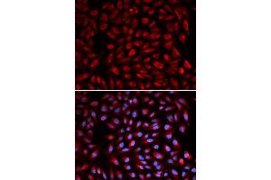 Immunofluorescence analysis of U2OS cell using RARA antibody. (Retinoic Acid Receptor alpha Antikörper)