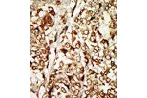Image no. 2 for anti-Moloney Sarcoma Oncogene (MOS) (N-Term) antibody (ABIN360532) (MOS Antikörper  (N-Term))