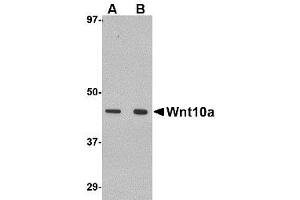 Image no. 1 for anti-Wingless-Type MMTV Integration Site Family, Member 10A (WNT10A) (C-Term) antibody (ABIN1492215) (WNT10A Antikörper  (C-Term))