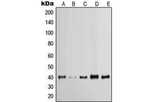Western blot analysis of Cytokeratin 19 expression in MCF7 (A), A431 (B), HeLa (C), HT29 (D), HepG2 (E) whole cell lysates.