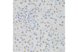 Immunohistochemistry of paraffin-embedded mouse kidney using SFN Antibody. (14-3-3 sigma/SFN Antikörper  (AA 1-248))