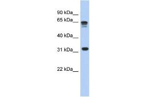 WB Suggested Anti-RPS3A Antibody Titration: 0. (RPS3A Antikörper  (N-Term))