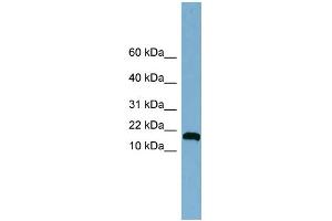 WB Suggested Anti-ANKRD37 Antibody Titration: 0.