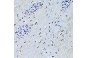 Immunohistochemistry (Paraffin-embedded Sections) (IHC (p)) image for anti-TAR DNA Binding Protein (TARDBP) (AA 1-260) antibody (ABIN3021656)