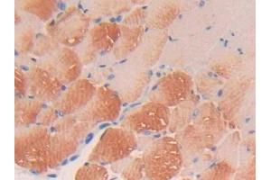 DAB staining on IHC-P; Samples: Mouse Skeletal muscle Tissue (PDGFC Antikörper  (AA 23-345))