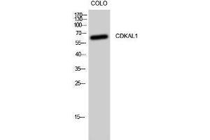 Western Blotting (WB) image for anti-CDK5 Regulatory Subunit Associated Protein 1-Like 1 (CDKAL1) (N-Term) antibody (ABIN3174325) (CDKAL1 Antikörper  (N-Term))