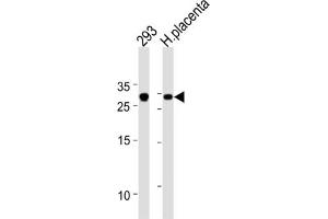 Western Blotting (WB) image for anti-Transcription Factor 21 (TCF21) antibody (ABIN2996267) (TCF21 Antikörper)