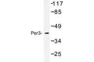 Western blot analysis of Per3 antibody in extracts from Jurkat cells treated with insulin 0. (PER3 Antikörper)