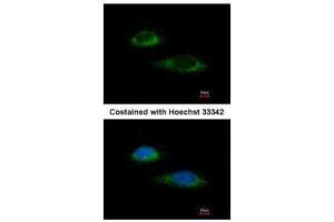 ICC/IF Image Immunofluorescence analysis of methanol-fixed HeLa, using Glutamate Dehydrogenase, antibody at 1:100 dilution. (GLUD1 Antikörper)