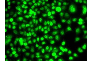 Immunofluorescence analysis of A549 cell using ETS2 antibody.