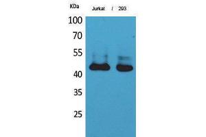 Western Blotting (WB) image for anti-SCCA1/2 (Internal Region) antibody (ABIN3181018) (SCCA1/2 (Internal Region) Antikörper)