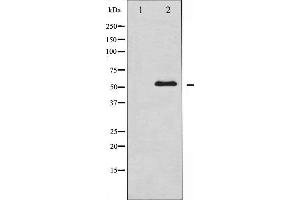 Western blot analysis of Chk1 expression in COS7 whole cell lysates,The lane on the left is treated with the antigen-specific peptide.