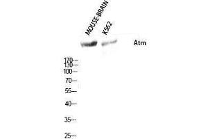 Western Blotting (WB) image for anti-Ataxia Telangiectasia Mutated (ATM) (Ser159) antibody (ABIN3173946) (ATM Antikörper  (Ser159))