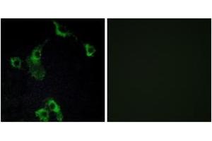 Immunofluorescence analysis of COS7 cells, using CIDEB Antibody. (CIDEB Antikörper  (AA 91-140))