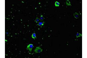 Immunofluorescence (IF) image for anti-Solute Carrier Family 29 (Nucleoside Transporters), Member 1 (SLC29A1) (AA 228-291) antibody (ABIN7151966)