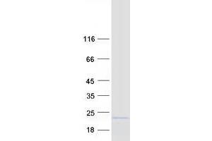 Validation with Western Blot