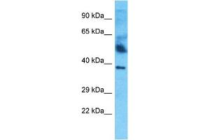 Host:  Rabbit  Target Name:  HPR  Sample Type:  Thymus Tumor lysates  Antibody Dilution:  1. (HPR Antikörper  (C-Term))