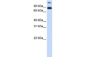 WB Suggested Anti-TMEM48 Antibody Titration:  0.