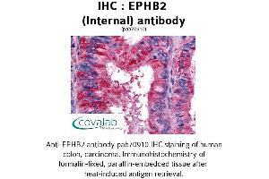Image no. 1 for anti-EPH Receptor B2 (EPHB2) (Internal Region) antibody (ABIN1734081) (EPH Receptor B2 Antikörper  (Internal Region))