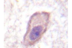 Immunohistochemistry analyzes of IFNGRA antibody in paraffin-embedded human brain tissue. (IFNGR1 Antikörper)