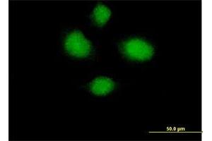 Immunofluorescence of purified MaxPab antibody to HSH2D on HeLa cell. (HSH2D Antikörper  (AA 1-352))