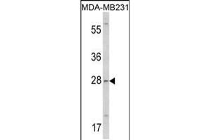 Western blot analysis of COLEC11 Antibody in MDA-MB231 cell line lysates (35ug/lane) (COLEC11 Antikörper  (N-Term))