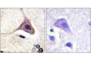 Immunohistochemistry analysis of paraffin-embedded human brain, using Opioid Receptor-delta (Phospho-Ser363) Antibody. (OPRD1 Antikörper  (pSer363))