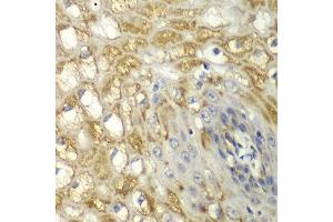 Immunohistochemistry of paraffin-embedded human esophageal using MYO1C antibody at dilution of 1:100 (x40 lens). (Myosin IC Antikörper)