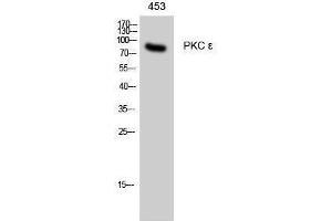 Western Blotting (WB) image for anti-Protein Kinase C, epsilon (PRKCE) (Thr308) antibody (ABIN3186475) (PKC epsilon Antikörper  (Thr308))