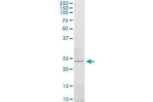 ATG5 monoclonal antibody (M06), clone 3G11. (ATG5 Antikörper  (AA 176-275))