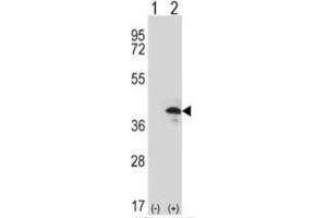 Western blot analysis: ZWINT Antibody staining of 293 cell lysates (2 µg/lane) either nontransfected (Lane 1) or transiently transfected (Lane 2) with the ZWINT gene.