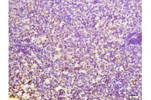 Formalin-fixed and paraffin embedded mouse lymphoma tissue labeled with Anti-CD24 Polyclonal Antibody, Unconjugated (ABIN1385707) at 1:200 followed by conjugation to the secondary antibody (CD24 Antikörper  (AA 27-53))