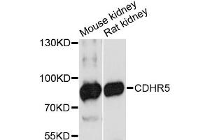 Western blot analysis of extracts of various cell lines, using CDHR5 antibody (ABIN6292199) at 1:3000 dilution. (CDHR5 Antikörper)