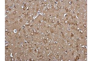 Immunohistochemistry (IHC) image for anti-Acyl-CoA Synthetase Long-Chain Family Member 4 (ACSL4) (C-Term) antibody (ABIN2854678)