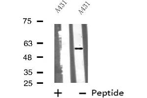 Western blot analysis of Cytochrome P450 51A1 using A431 whole cell lysates