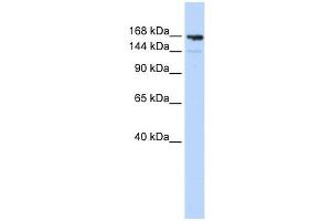 Periplakin antibody used at 1 ug/ml to detect target protein. (PPL Antikörper  (Middle Region))