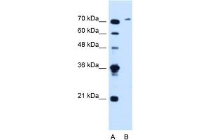 WB Suggested Anti-SLCO6A1 Antibody Titration:  1. (SLCO6A1 Antikörper  (C-Term))