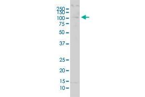 USP51 polyclonal antibody (A01). (USP51 Antikörper  (AA 261-337))
