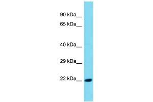 Host: Rabbit Target Name: SIGLECL1 Sample Type: Fetal Kidney lysates Antibody Dilution: 1. (SIGLECL1 Antikörper  (C-Term))